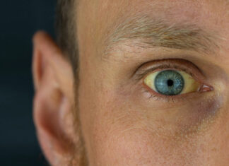 A thiazolidinedione for hepatitis B