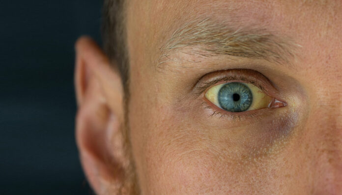 old-drug-feb-march-22-feature