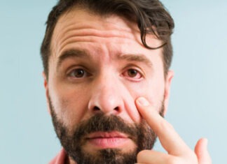 Conjunctivitis – an irritating condition