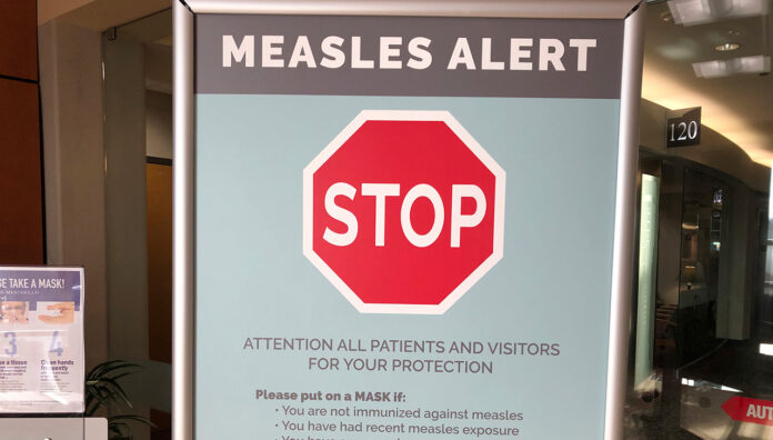20190131001382912946-original_WEB measles