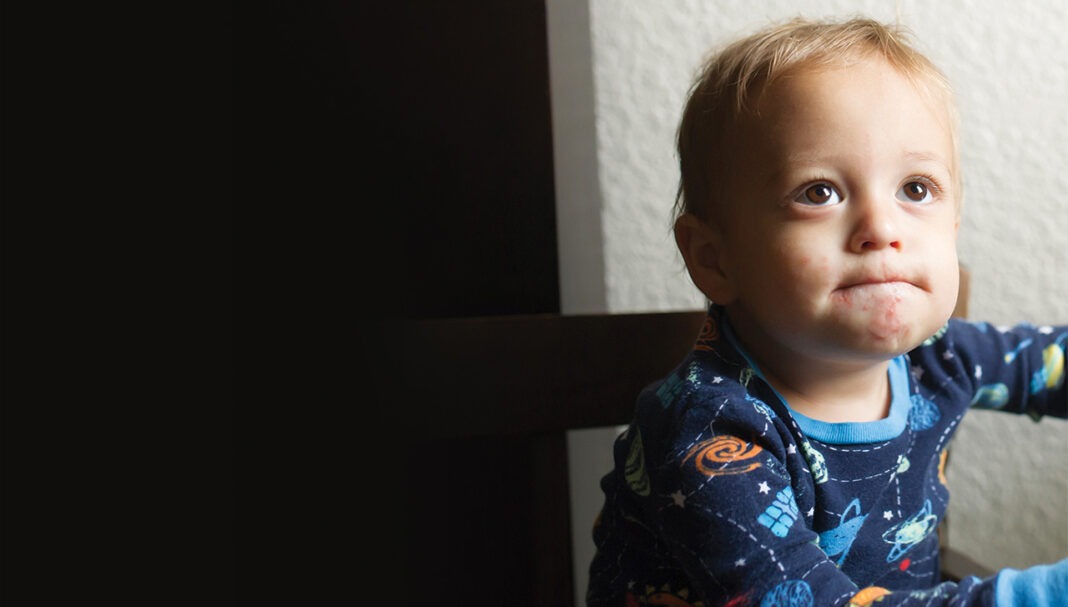 hand-foot-mouth-disease-GettyImages-975516848
