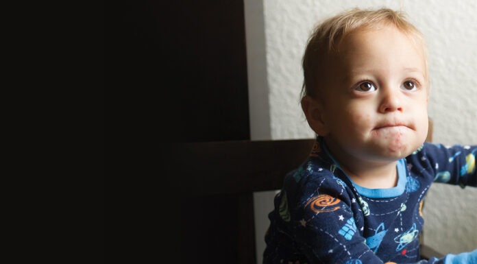 Management of hand, foot and mouth disease