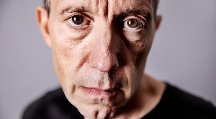 Age-related macular degeneration