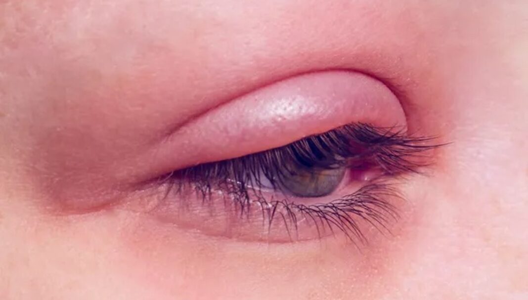 GettyImages-875307146-c2d5f2e2ac6043329da607d60aecf8b6