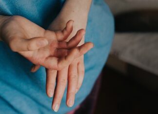 Scabies diagnosis and management