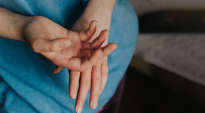 Scabies diagnosis and management