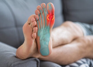 Improving gout management one step at a time