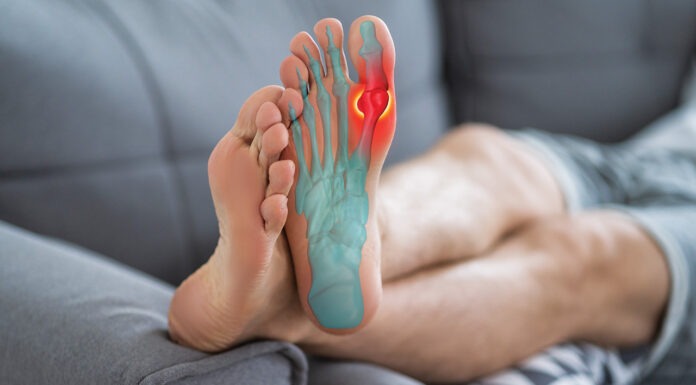 Improving gout management one step at a time