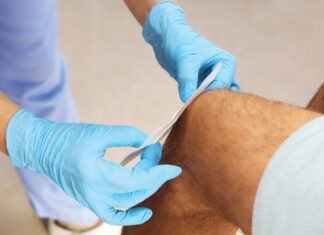 Managing chronic wounds