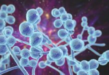 Is it actually thrush?