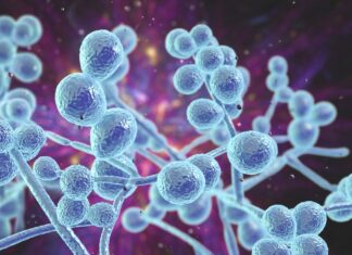 Is it actually thrush?