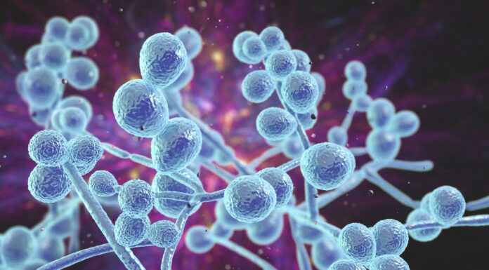 Is it actually thrush?