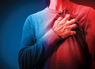 Venous thromboembolism