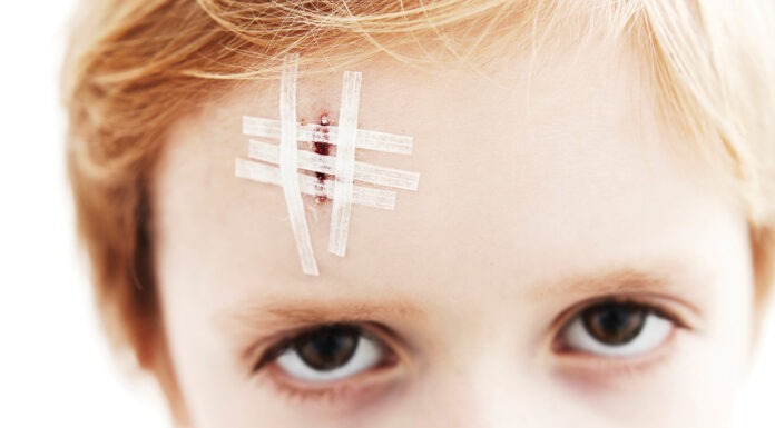 The management of acute wounds commonly seen in community pharmacy