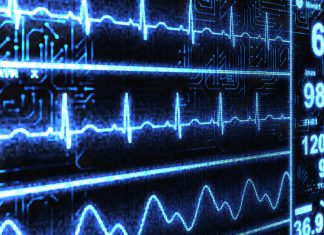 Diclofenac associated with cardiovascular health risk