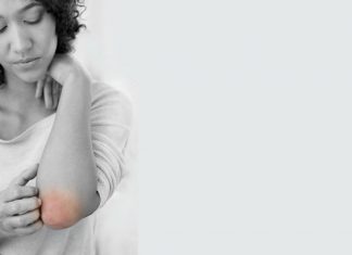 The effectiveness of probiotics for the treatment of eczema eczema