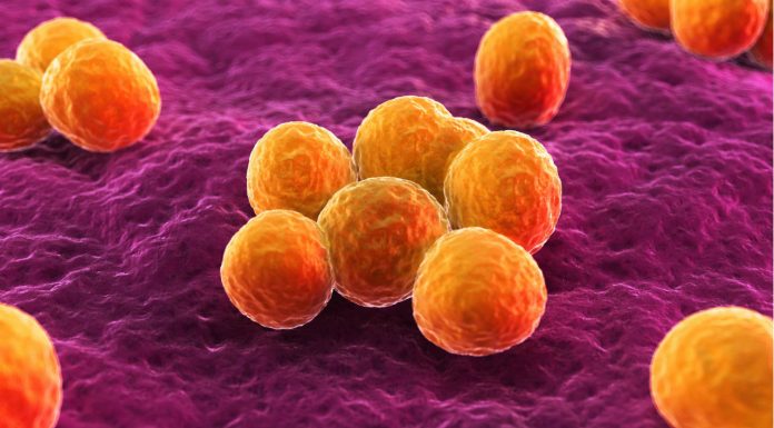The rise of community-associated golden staph infections S. aureus