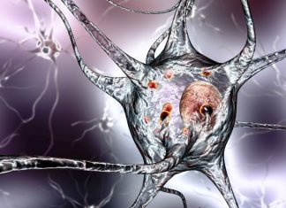 PBS listings for cancer, Parkinson’s and motor neurone disease PBS