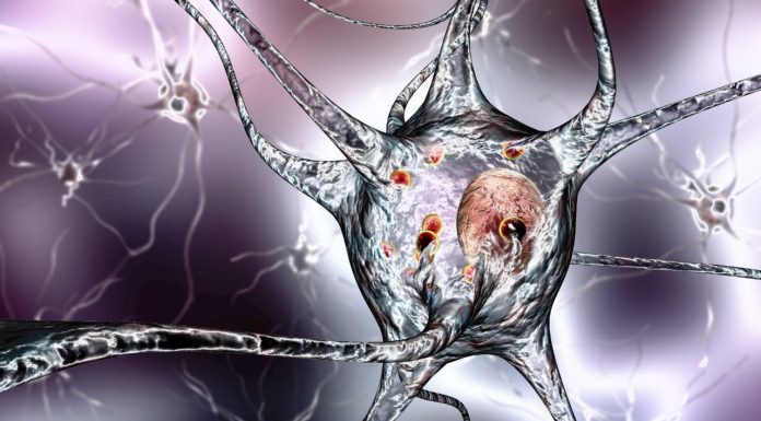 PBS listings for cancer, Parkinson’s and motor neurone disease PBS