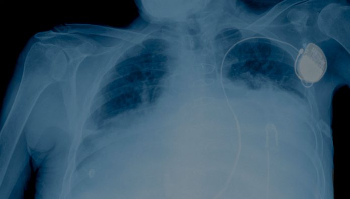 80-81_PSA12_EVID_2 corticosteroids