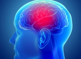 Pharmacists’ role in managing Parkinson’s disease Parkinson's