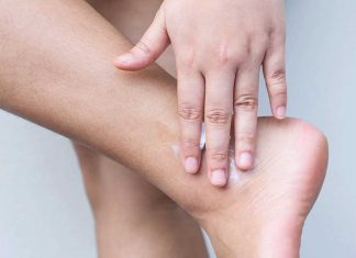 Dry skin management dry skin