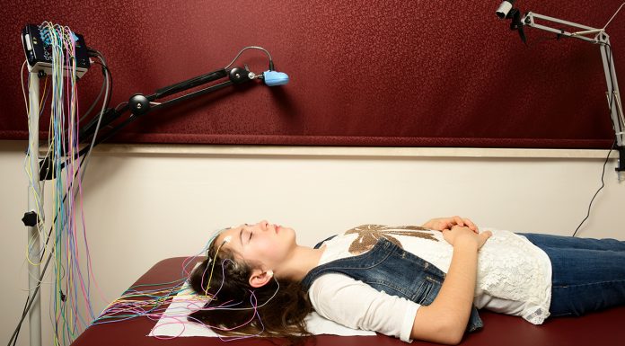 Pregabalin add-on for drug-resistant focal epilepsy