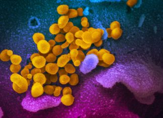 COVID-19 death toll passes 2000 A scanning electron microscope image shows SARS-CoV-2 (yellow) – also known as 2019-nCoV, the virus that causes COVID-19 –isolated from a patient in the US, emerging from the surface of cells (blue/pink) cultured in a lab. Image: NIAID-RML