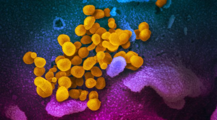 COVID-19 death toll passes 2000 A scanning electron microscope image shows SARS-CoV-2 (yellow) – also known as 2019-nCoV, the virus that causes COVID-19 –isolated from a patient in the US, emerging from the surface of cells (blue/pink) cultured in a lab. Image: NIAID-RML