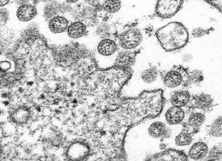 What pharmacists need to know about COVID-19 A microscopic image of an isolate from the first US case of COVID-19. Image: Centres for Disease Control and Prevention