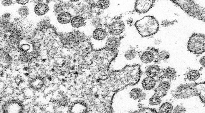 What pharmacists need to know about COVID-19 A microscopic image of an isolate from the first US case of COVID-19. Image: Centres for Disease Control and Prevention