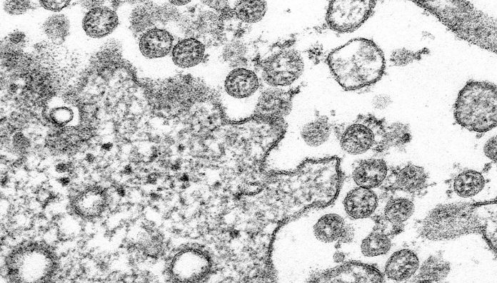 novel-coronavirus-covid-19-cdc-feature A microscopic image of an isolate from the first US case of COVID-19. Image: Centres for Disease Control and Prevention