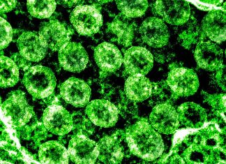 COVID-19 spreading locally