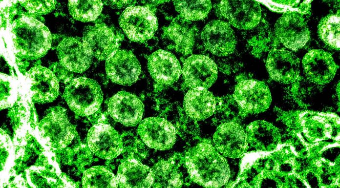 COVID-19 spreading locally