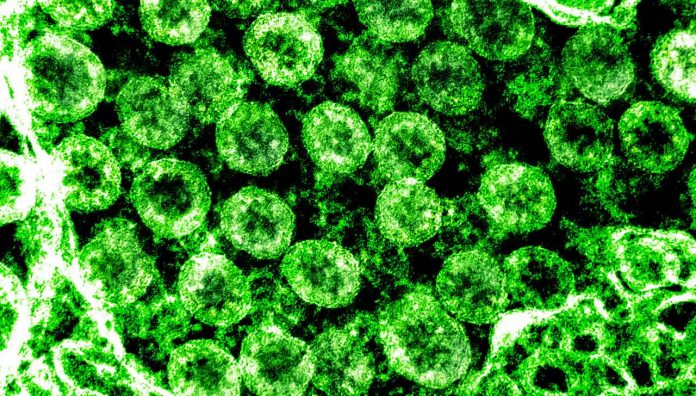 COVID-19-spreading-locally-feature