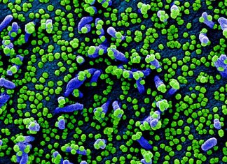 COVID-19: Medicine supply changes and increased social distancing