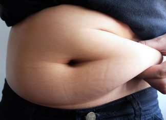 Australia’s rising obesity burden: can pharmacists help?