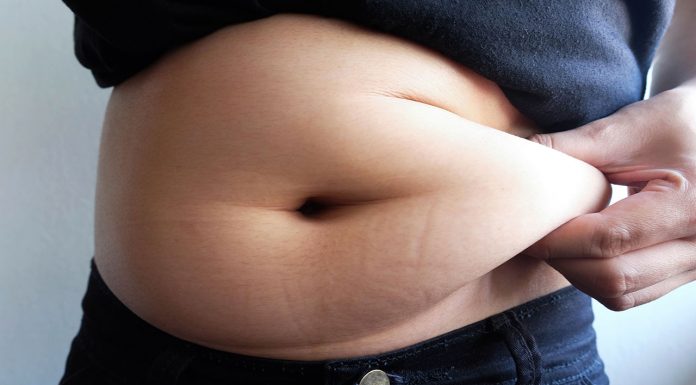 Australia’s rising obesity burden: can pharmacists help?