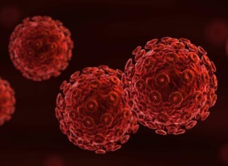 HIV management in Australia – Part 1