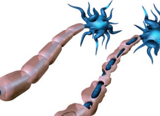 The efficacy of ocrelizumab for multiple sclerosis