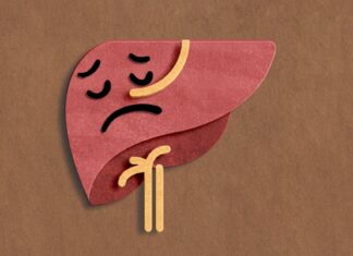 Patient death sparks turmeric and curcumin concerns turmeric