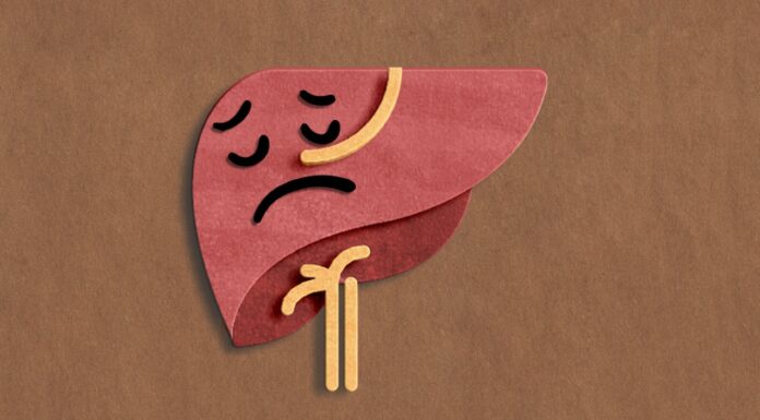 Patient death sparks turmeric and curcumin concerns turmeric