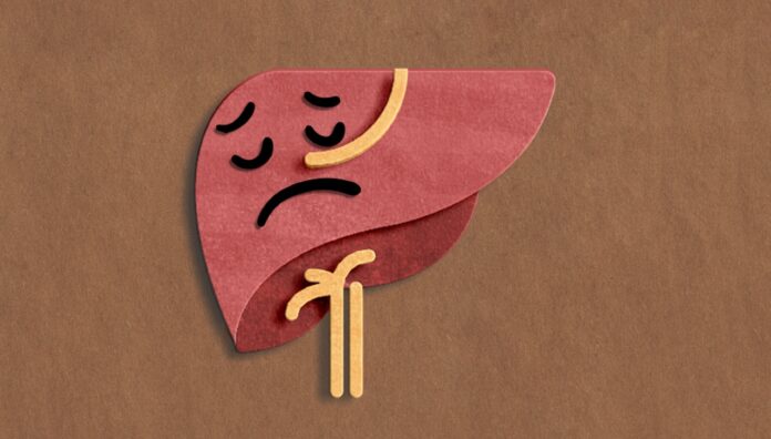 GettyImages-1481333730-2 turmeric