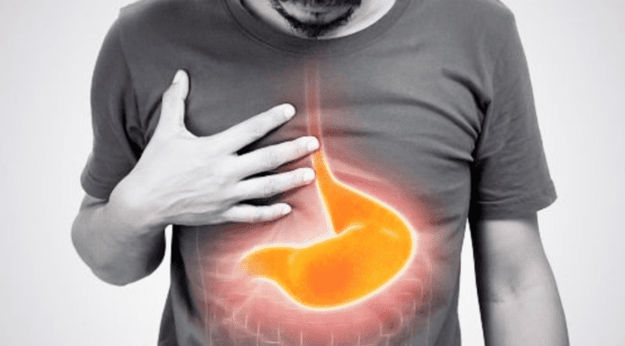 Why is my PPI not working?