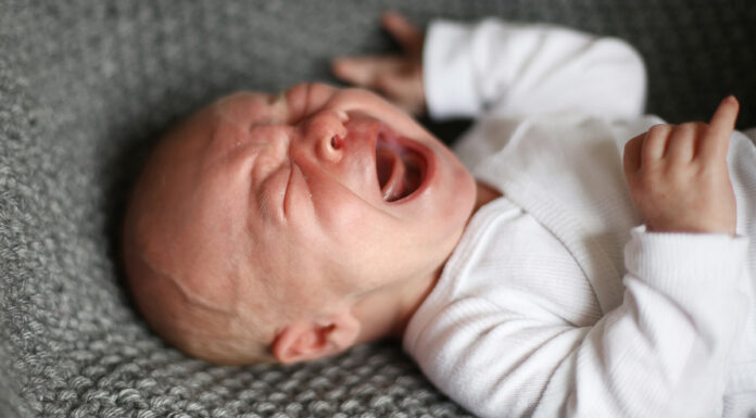 Belladonna toxicity linked to colic preparations