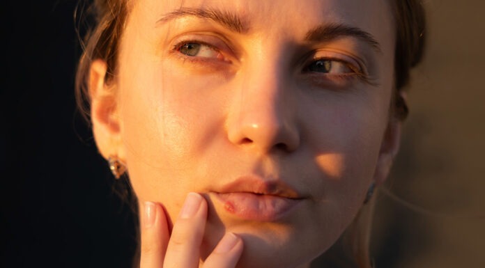 Famciclovir fundamentals Famciclovir