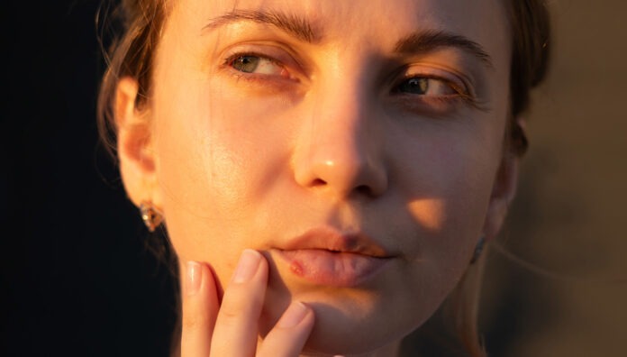 GettyImages-2166254179_web Famciclovir