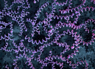 Congenital syphilis cases on the rise syphilis