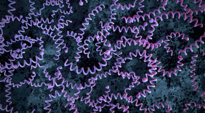 Congenital syphilis cases on the rise syphilis