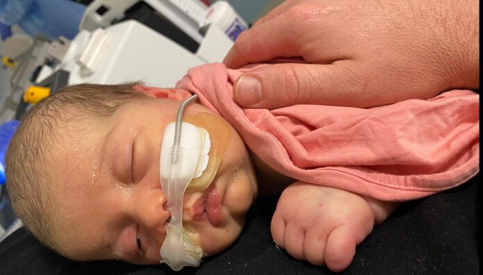 RSV hospitalises more babies than any other virus (1)_web RSV